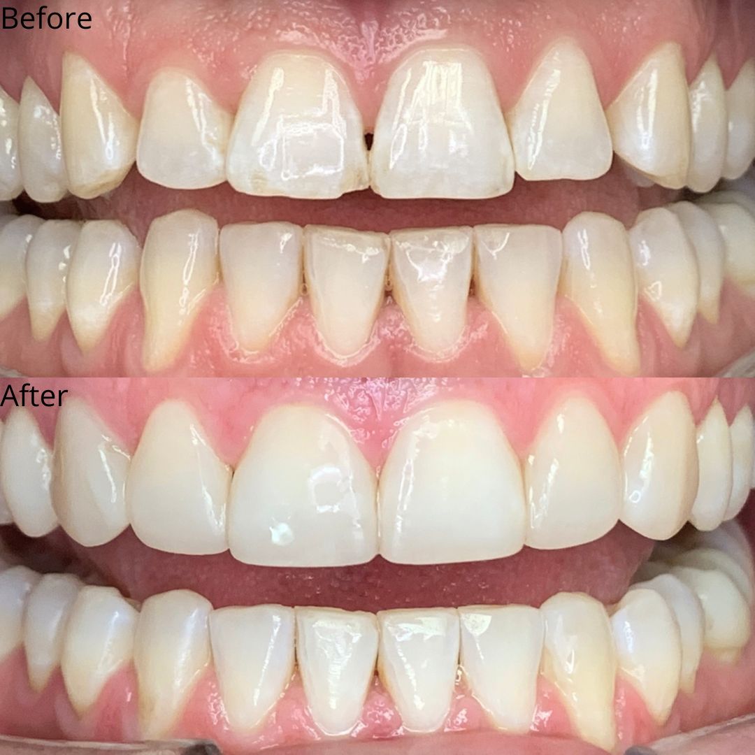 Smile Gallery Smile Gallery