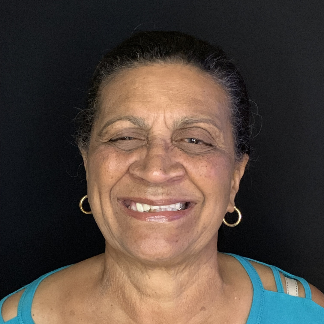 Dentures Dentures before treatment