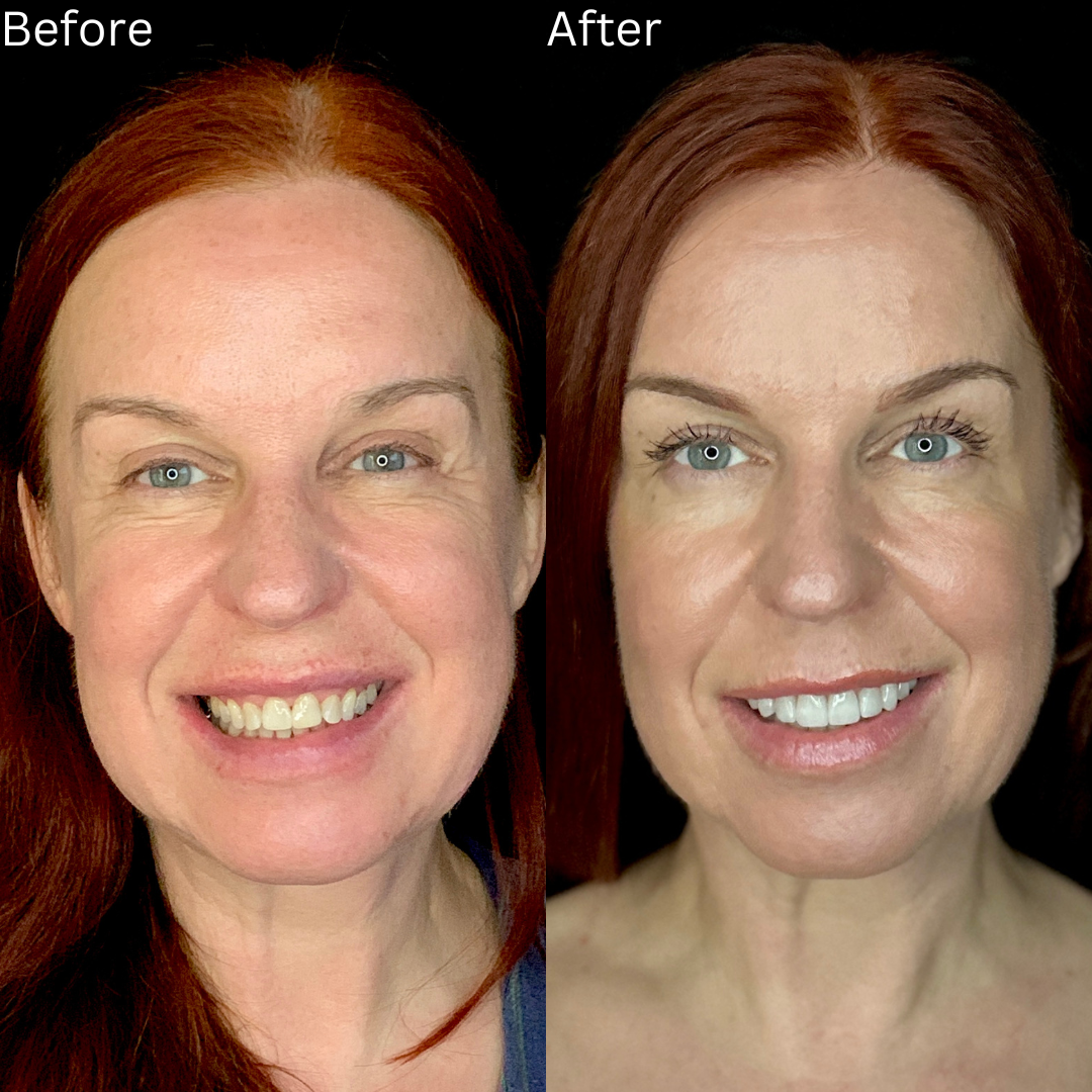Cosmetic Dentistry Before and After