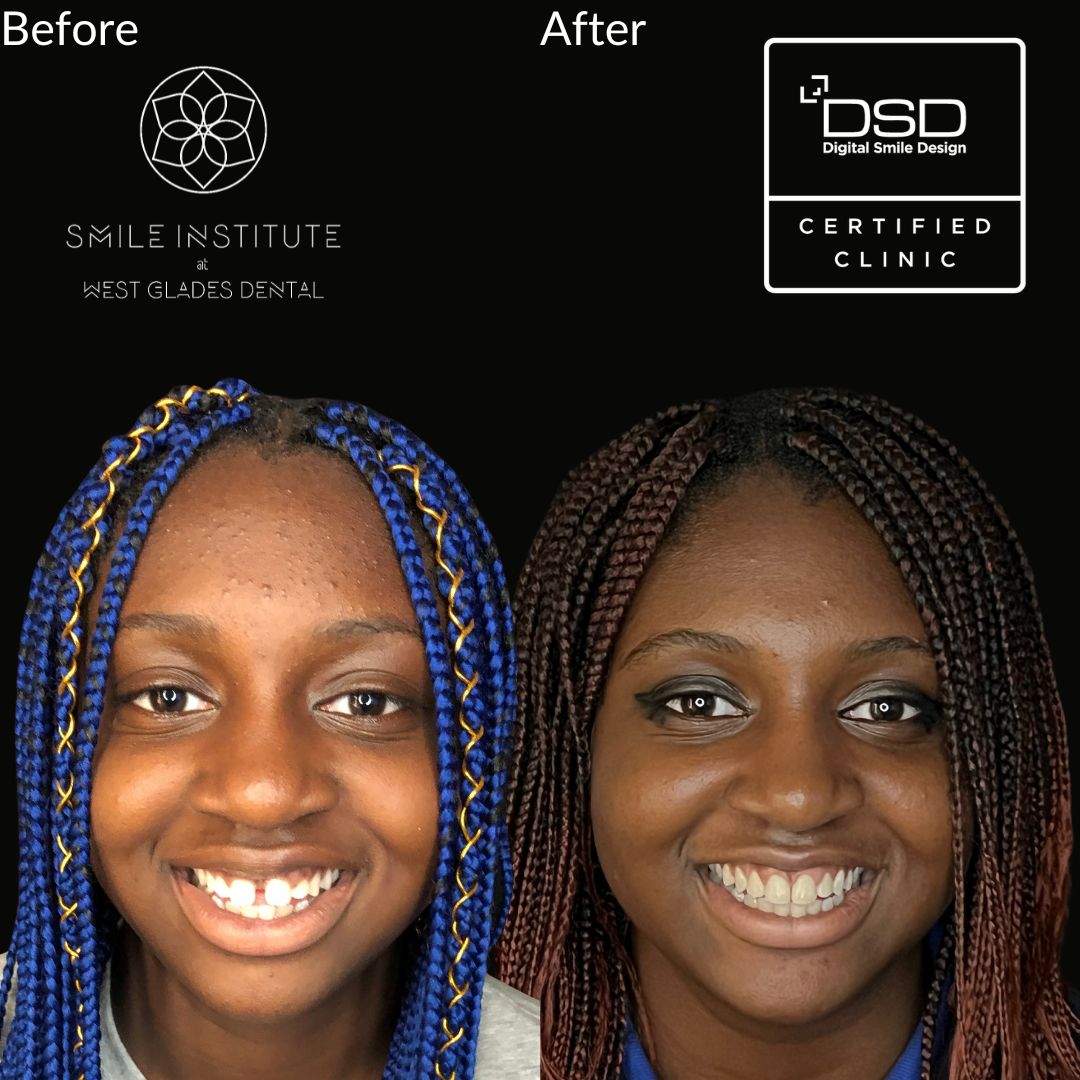 Smile Gallery Smile Gallery