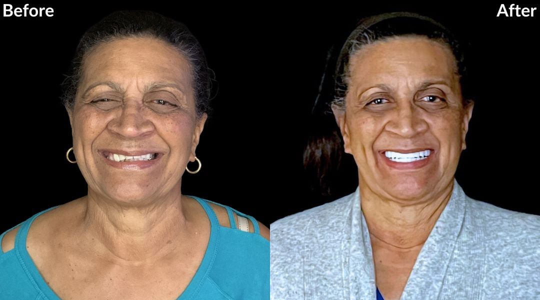 Treatments My dentures are causing me problems