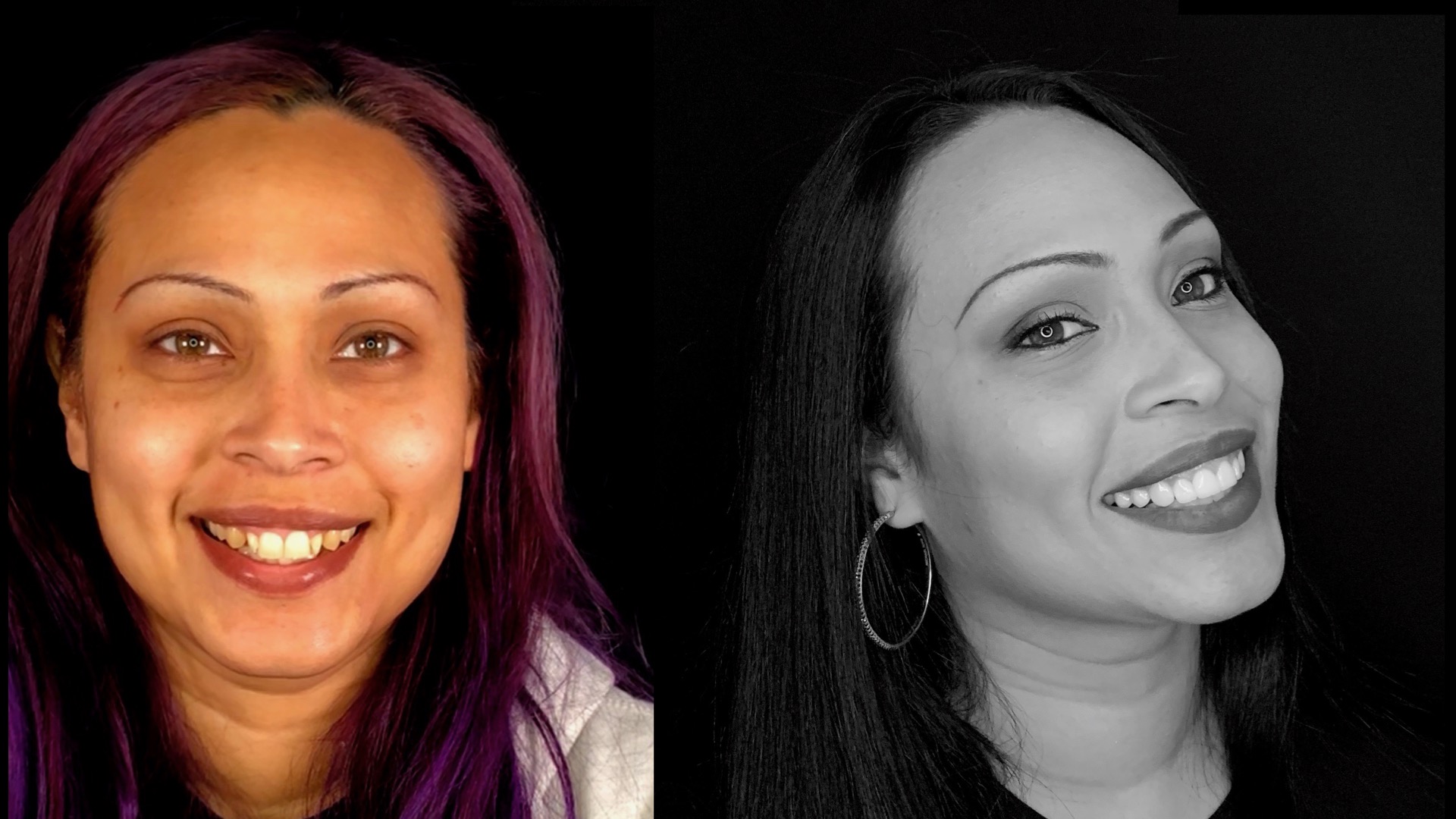 Porcelain Veneers Digital Smile Design